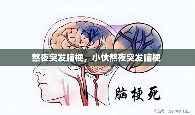 熬夜突發(fā)腦梗，小伙熬夜突發(fā)腦梗 