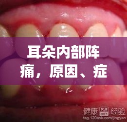 耳朵內(nèi)部陣痛，原因、癥狀及有效治療方法揭秘