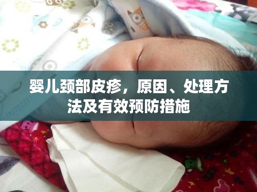 嬰兒頸部皮疹，原因、處理方法及有效預(yù)防措施