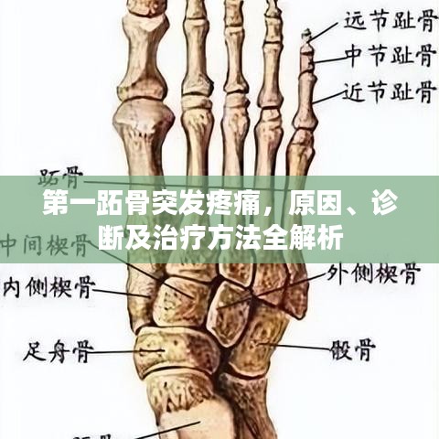 第一跖骨突發(fā)疼痛，原因、診斷及治療方法全解析